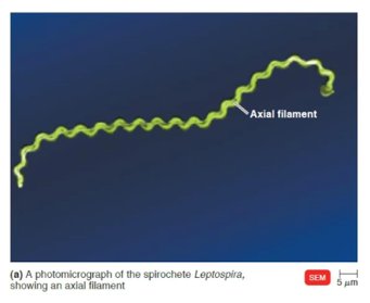 SEM image of spirochete with axial filament