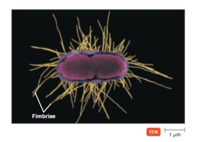 TEM image showing fimbriae on a bacterial cell