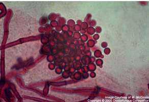 Candida albicans under microscope