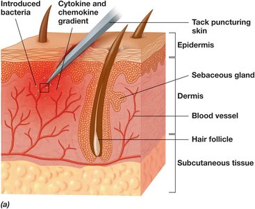 Inflammatory response to trauma and vasodilation