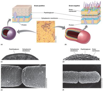 Gram-positive vs. Gram-negative cell wall structure