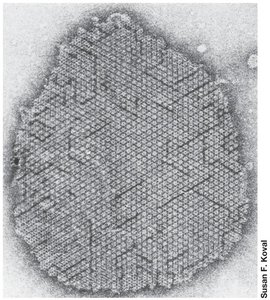 S-layer structure in Archaea