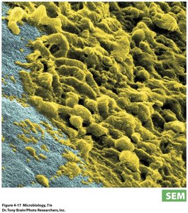 Bacteria growing on tooth enamel (biofilm)