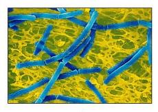 Bacilli in chains (streptobacilli)