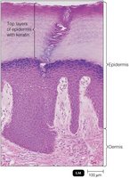 Cross-section of skin showing epidermis and dermis as physical barriers