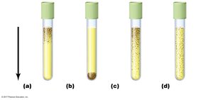 Test tubes showing different patterns of microbial growth based on oxygen requirements