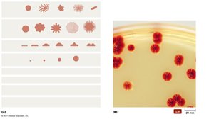 Colony morphology: shapes, margins, elevations, and pigmentation of bacterial colonies