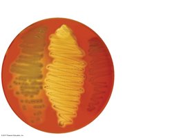 Blood agar as a differential medium showing alpha, beta, and gamma hemolysis