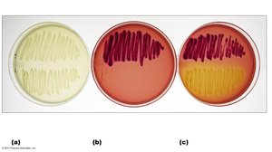 MacConkey agar as a selective and differential medium