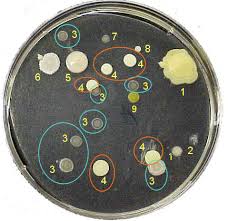 Bacterial colonies in a petri dish