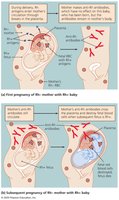 Development of hemolytic disease of the newborn