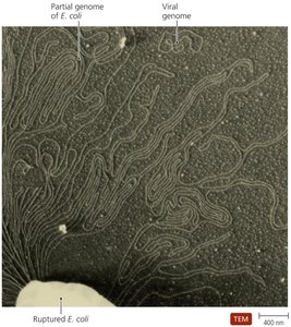 TEM of viral and E. coli genomes