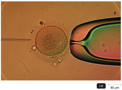 Microinjection of DNA into a cell