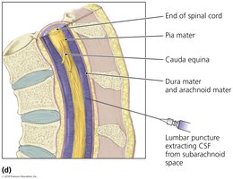 Lumbar puncture extracting CSF from subarachnoid space