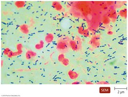 Streptococcus pneumoniae cells in pairs