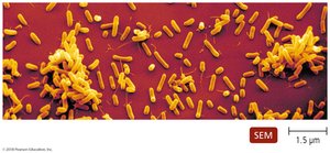 SEM of Haemophilus influenzae bacilli