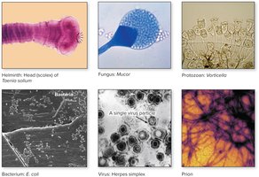 Microscopic images of major types of microorganisms