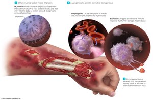 Necrotizing fasciitis tissue destruction