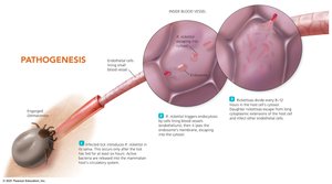 Pathogenesis of Rocky Mountain spotted fever