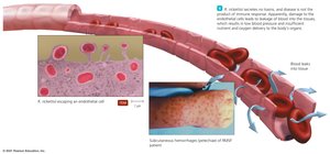 Rickettsia escaping endothelium