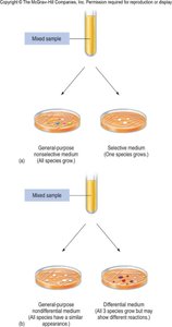 Comparison of general purpose, selective, and differential media