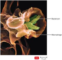Macrophage engulfing Mycobacterium tuberculosis