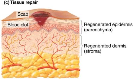 Tissue repair after inflammation