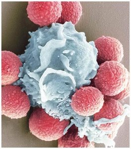 Neutrophil phagocytizing fungal spores
