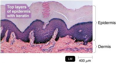 Histological section of skin showing epidermis with keratin and dermis
