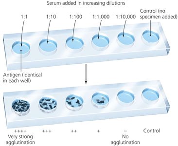 Agglutination titration test
