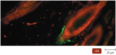 Direct fluorescent immunoassay