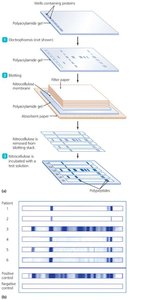 Immunoblotting (Western Blot)