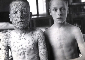 Historical image of smallpox and vaccination