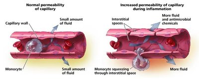 Diagram of vasodilation and increased capillary permeability during inflammation