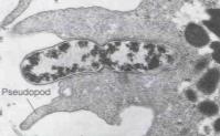 Diagram of the stages of phagocytosis