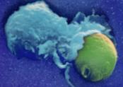Micrograph of a phagocyte ingesting a microbe