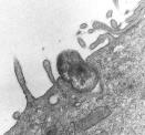 Micrograph of a phagocyte ingesting a microbe