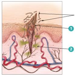 Diagram of the inflammatory response: tissue injury and signaling molecules