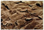 Scanning electron micrograph of the skin surface