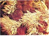 Micrograph of cilia on epithelial cells