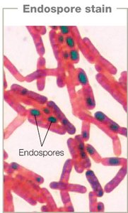 Endospore stain