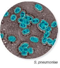 S. pneumoniae under electron microscopy