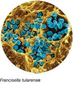 Francisella tularensis under electron microscopy