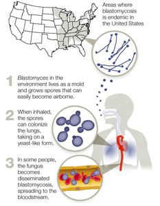 Blastomyces transmission and infection cycle
