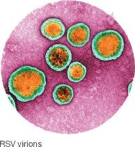 RSV virions under electron microscopy