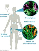 Biofilms and medical devices