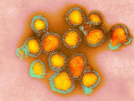 Microscopic image of viruses