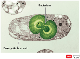 TEM image of bacterium inside eukaryotic host cell