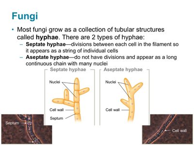 Diagram of septate and aseptate hyphae