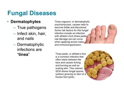 Images of tinea infections and fungal spores